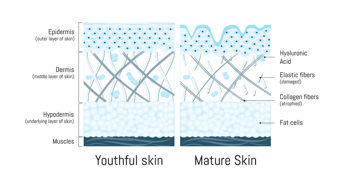 How collagen supports the skin